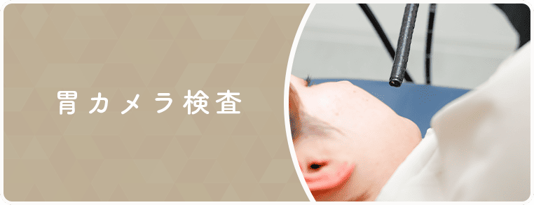 胃カメラ検査のバナー