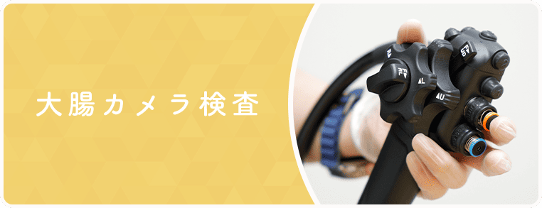 大腸カメラ検査のバナー